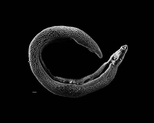Schistosoma 20041-300