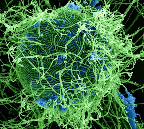 Ebola Virus Particles (5)