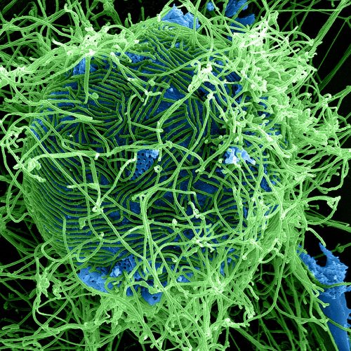 Ebola Virus Particles (5)