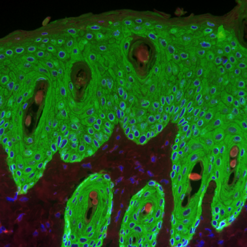 Proliferative response induced by a tumor promoter in the epidermis of a wild-type mouse - image.pbio.v11.i07.g001