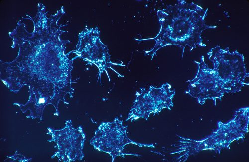 Cancer cells (1)